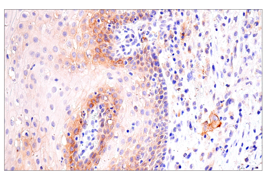 Immunohistochemistry Image 2: Transferrin Receptor/CD71 (10F11) Mouse Monoclonal Antibody