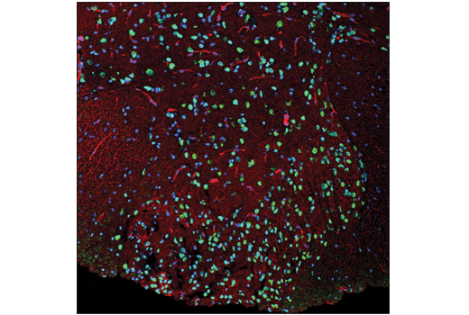 Immunofluorescence Image 1: TDP43 (D9R3L) Rabbit Monoclonal Antibody (BSA and Azide Free)
