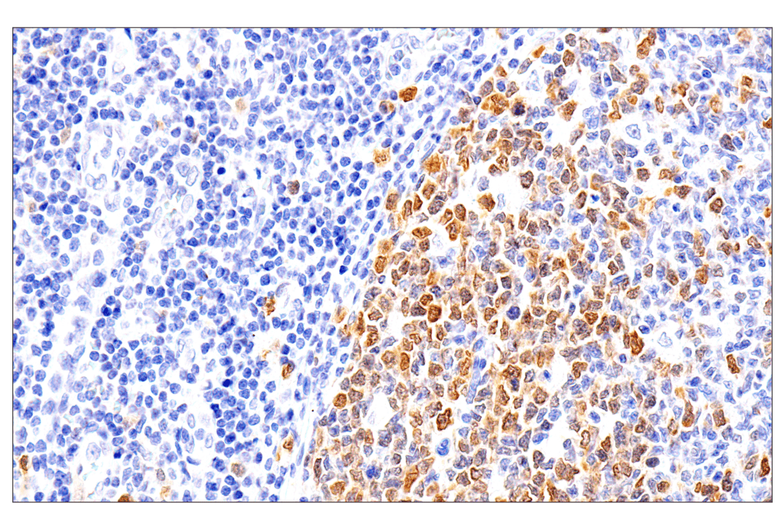 undefined Image 33: Phospho-Chk1/2 Antibody Sampler Kit