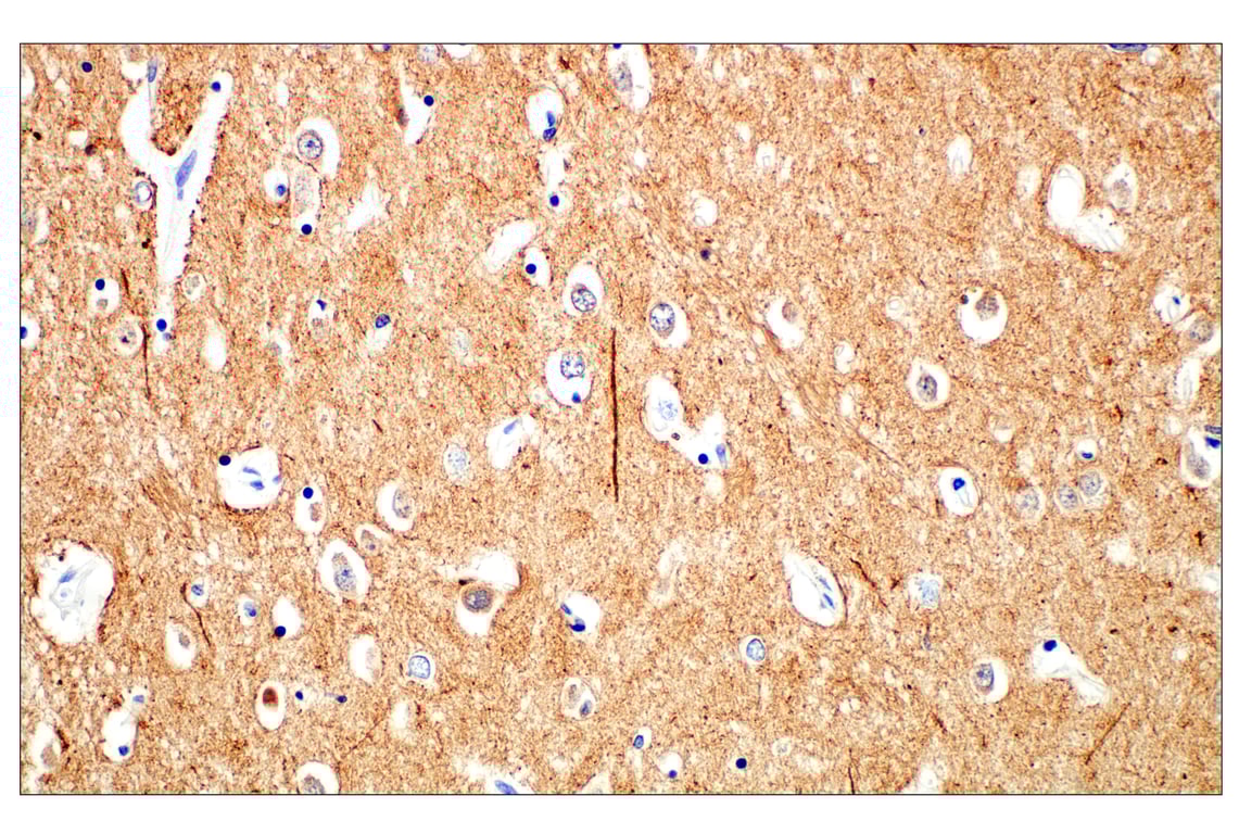 Immunohistochemistry Image 1: beta3-Tubulin (E9F3E) Mouse Monoclonal Antibody (BSA and Azide Free)