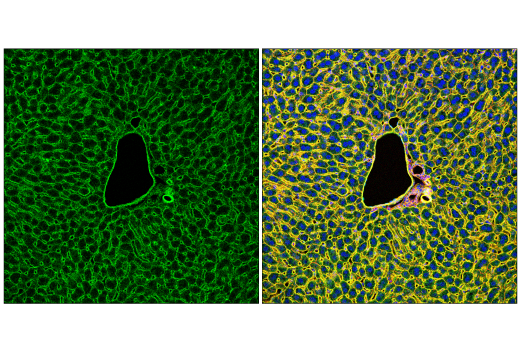 Immunofluorescence Image 1: Insulin Receptor β (E9L5V) XP<sup>®</sup> Rabbit mAb (BSA and Azide Free)