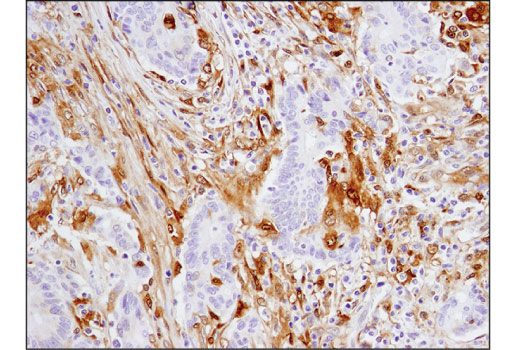 Immunohistochemistry Image 2: Galectin-9 (D9R4A) Rabbit Monoclonal Antibody