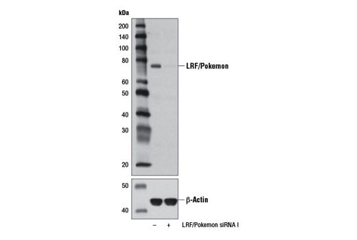 Western Blotting Image 3: LRF/Pokemon Antibody
