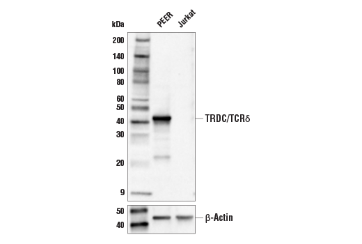 Western Blotting Image 2: TRDC/TCR delta (E2E9T) Rabbit Monoclonal Antibody (BSA and Azide Free)