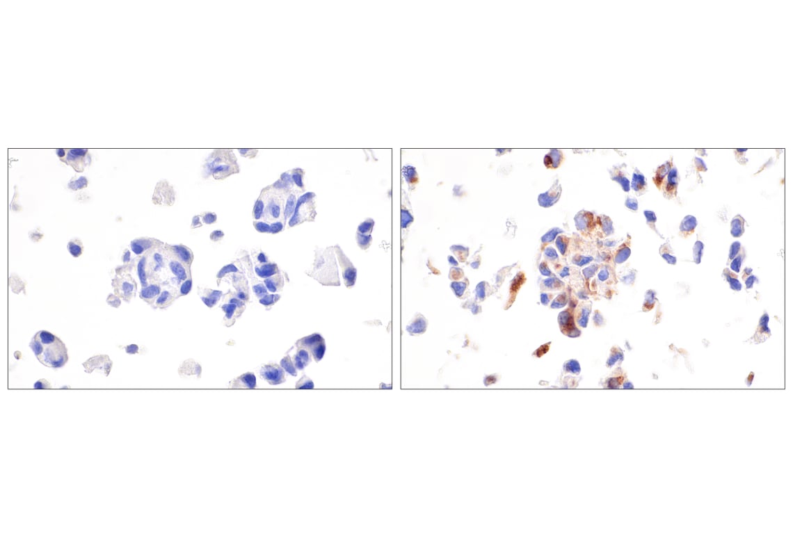 Immunohistochemistry Image 6: CXCL9/MIG (E6Z5W) Rabbit Monoclonal Antibody