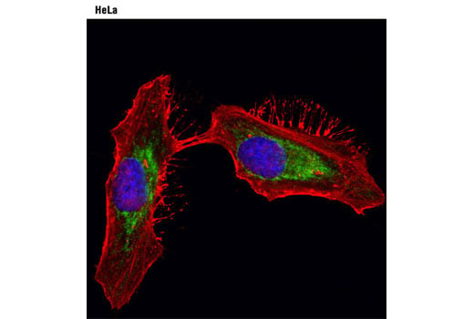 Immunofluorescence Image 1: ProLong<sup>®</sup> Gold Antifade Reagent