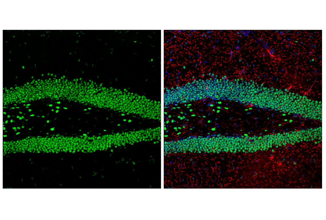 Immunofluorescence Image 2: Matrin 3 (F4Q5F) Rabbit Monoclonal Antibody