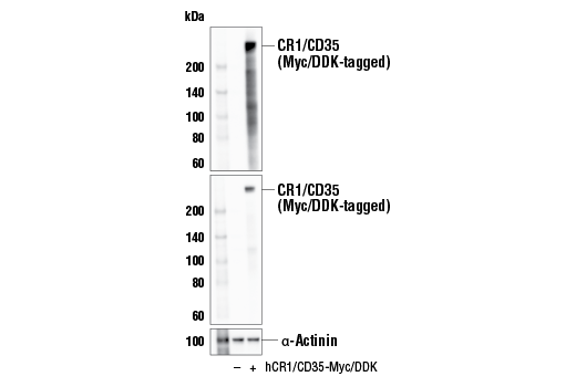 Western Blotting Image 2: CR1/CD35 (E8S3X) Rabbit Monoclonal Antibody