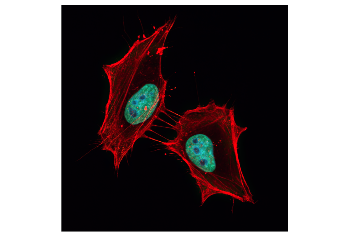 Immunofluorescence Image 1: Histone H3 (1B1B2) Mouse Monoclonal Antibody