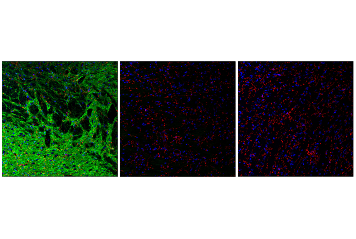 Immunofluorescence Image 2: Phospho-Tau (Ser396) (F3S9T) Rabbit Monoclonal Antibody