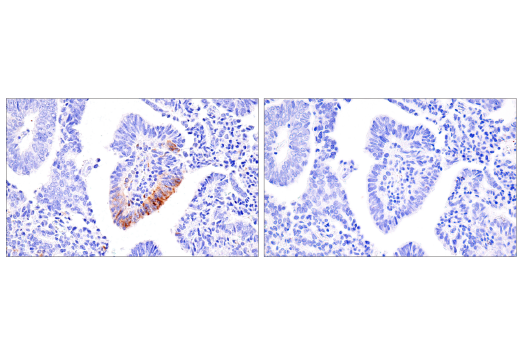 Immunohistochemistry Image 4: CXCL9/MIG (E6Z5W) Rabbit Monoclonal Antibody (BSA and Azide Free)
