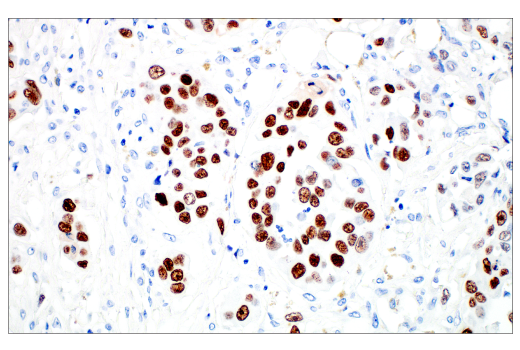 Immunohistochemistry Image 4: MAGE-C2/CT10 (E7B8D) Rabbit Monoclonal Antibody