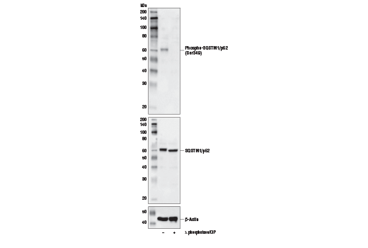 undefined Image 21: p62/KEAP1/NRF2 Pathway Antibody Sampler Kit
