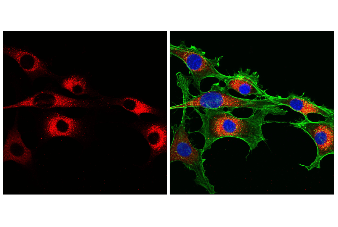 Immunofluorescence Image 1: Cathepsin D (E7Z4L) Rabbit Monoclonal Antibody (Alexa Fluor<sup>®</sup> 647 Conjugate)
