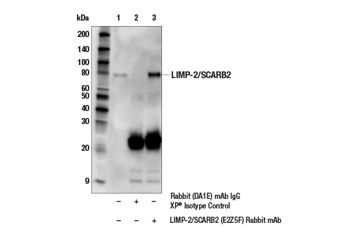 Immunoprecipitation Image 1: LIMP-2/SCARB2 (E2Z5F) Rabbit Monoclonal Antibody