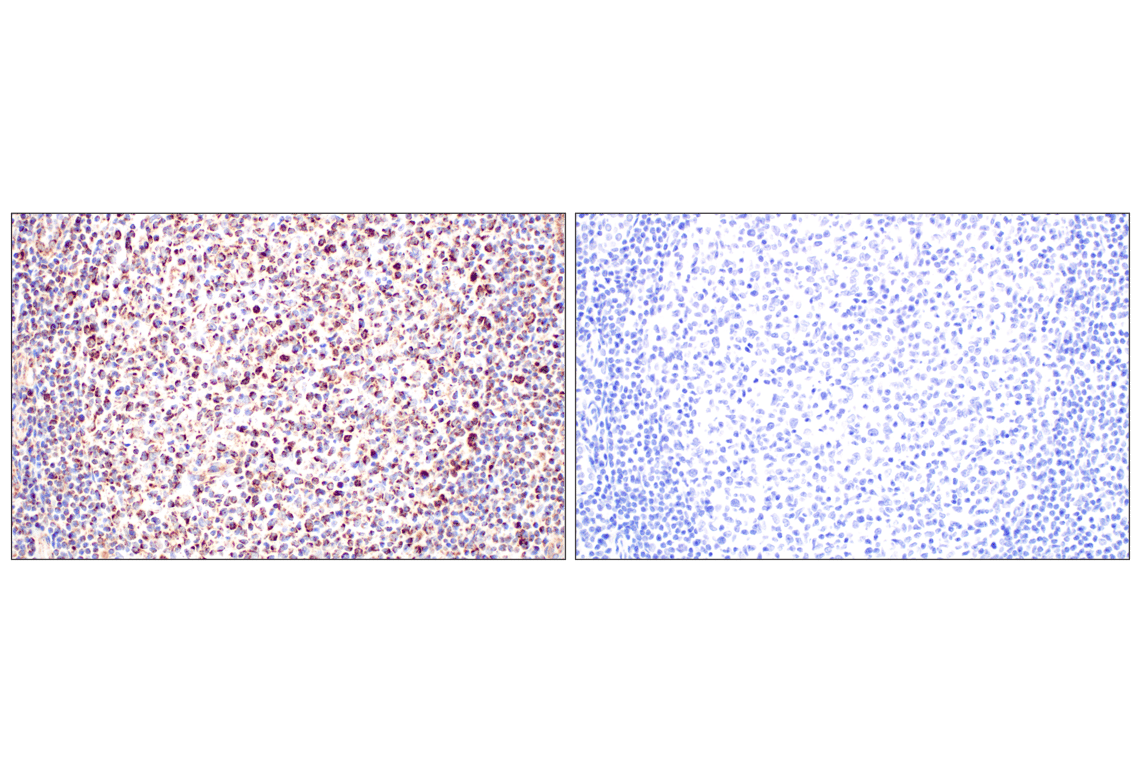 Immunohistochemistry Image 13: GOT2 (F4P3R) Rabbit Monoclonal Antibody (BSA and Azide Free)