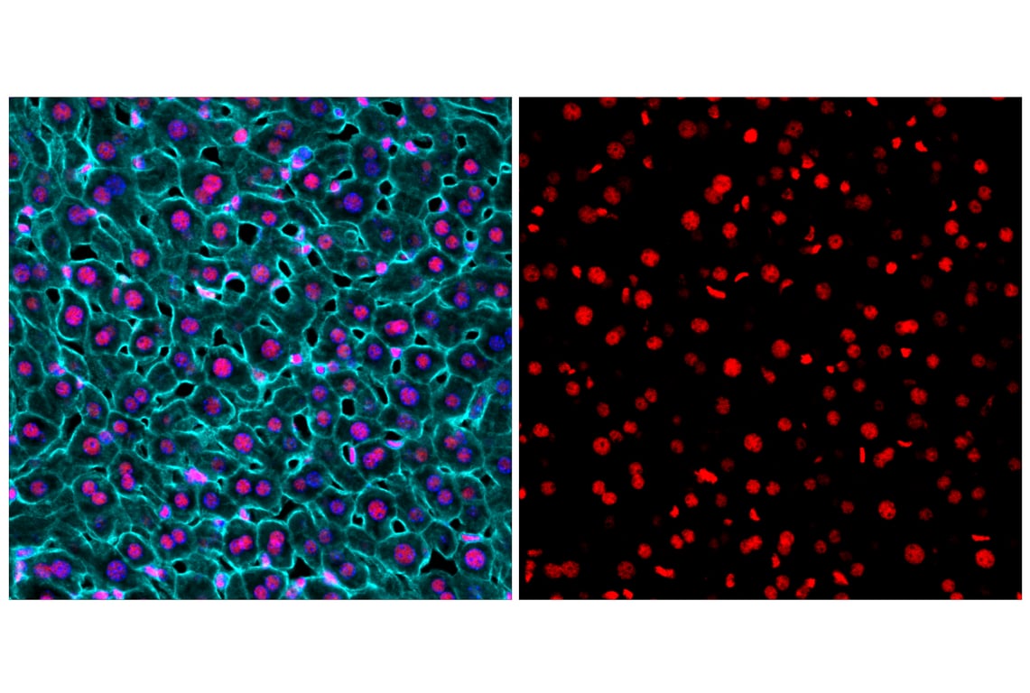 Immunofluorescence Image 3: TDP43 (D9R3L) Rabbit Monoclonal Antibody (Alexa Fluor<sup>®</sup> 555 Conjugate)