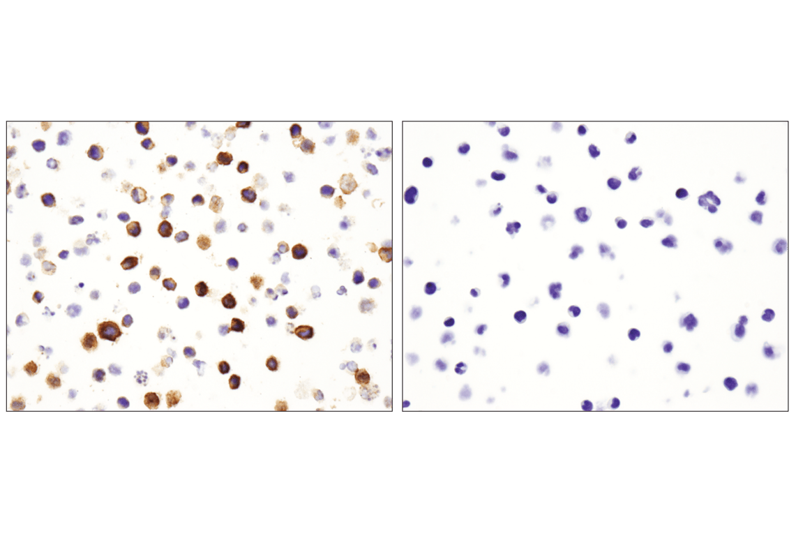 Immunohistochemistry Image 5: CD36 (D8L9T) Rabbit Monoclonal Antibody (BSA and Azide Free)