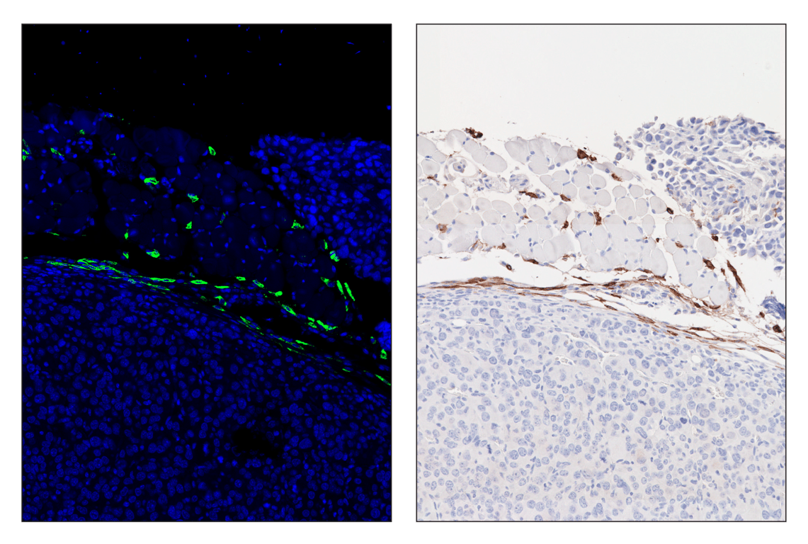 Immunohistochemistry Image 2: LYVE-1 (E5P8S) & CO-0148-488 SignalStar<sup>™</sup> Oligo-Antibody Pair