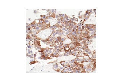 Immunohistochemistry Image 1: Pan-Keratin (C11) Mouse Monoclonal Antibody