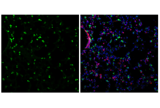 Immunofluorescence Image 1: SCD1 (C12H5) Rabbit Monoclonal Antibody