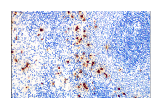 Immunohistochemistry Image 7: S100A9 (D3U8M) Rabbit Monoclonal Antibody (BSA and Azide Free)