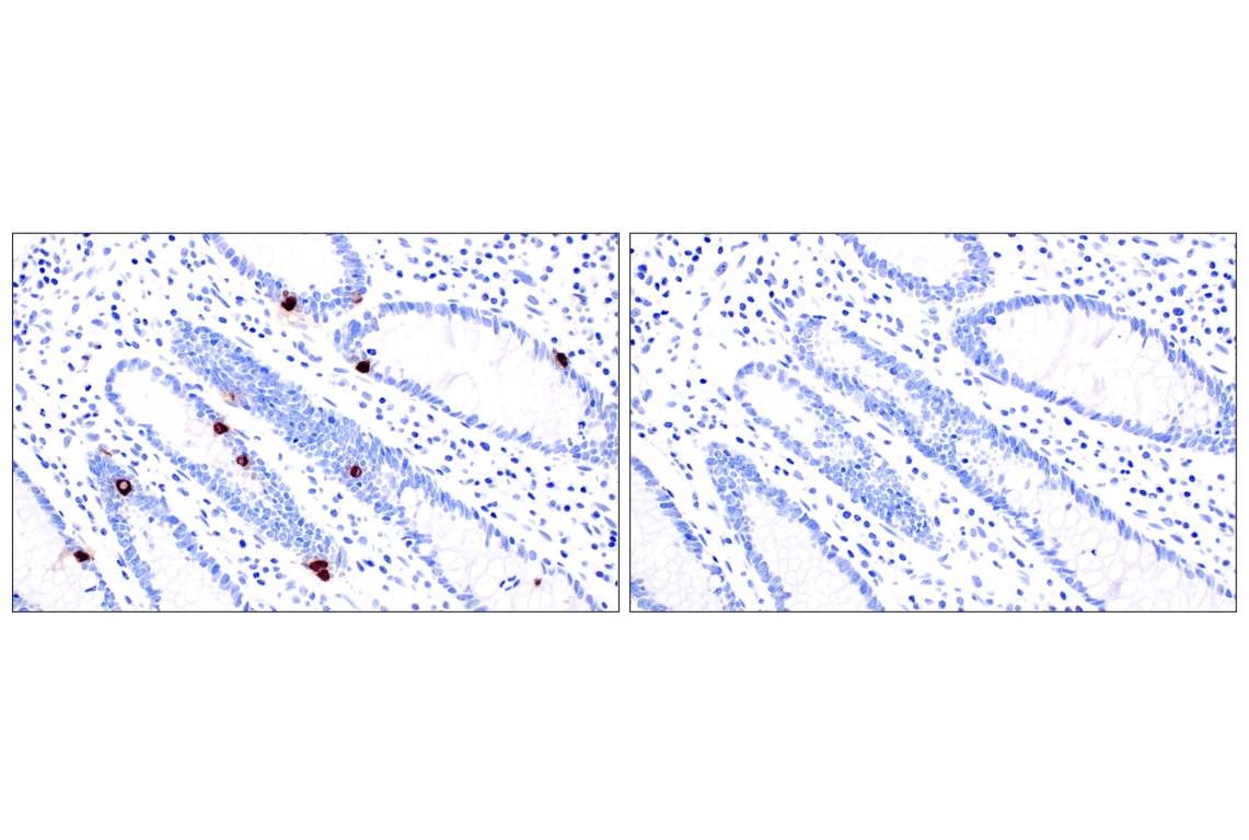 Immunohistochemistry Image 7: CHGA (F7D6H) Rabbit Monoclonal Antibody (BSA and Azide Free)