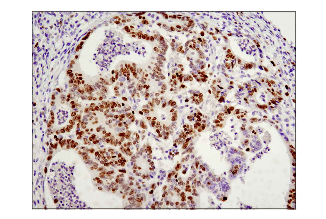 Immunohistochemistry Image 2: Ki-67 (D2H10) Rabbit Monoclonal Antibody