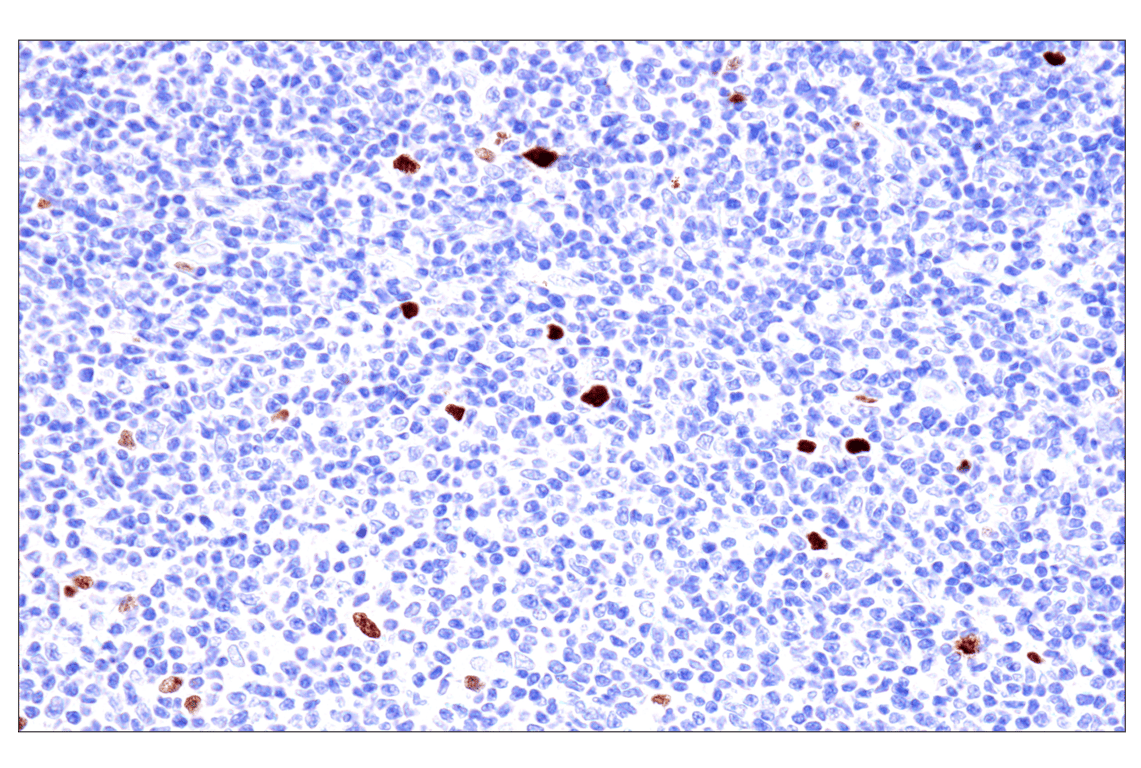 Immunohistochemistry Image 4: Phospho-NPM1 (Thr199) (E4C7S) Rabbit Monoclonal Antibody (BSA and Azide Free)