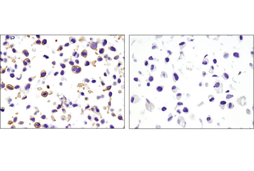 Non-phospho (Active) β-Catenin (Ser45) (D2U8Y) XP® Rabbit Non-phospho (Active) β-Catenin (Ser45) (D2U8Y) XP® Rabbit
