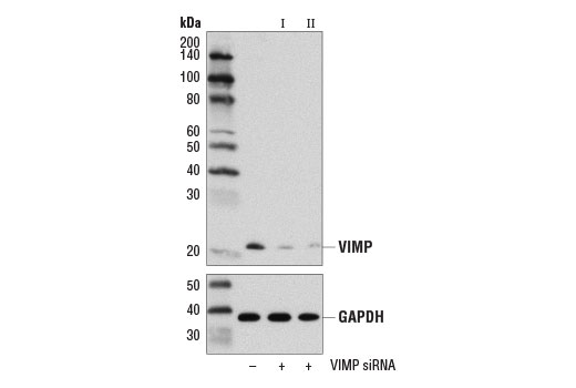Western Blotting Image 2: VIMP (D1D1M) Rabbit Monoclonal Antibody