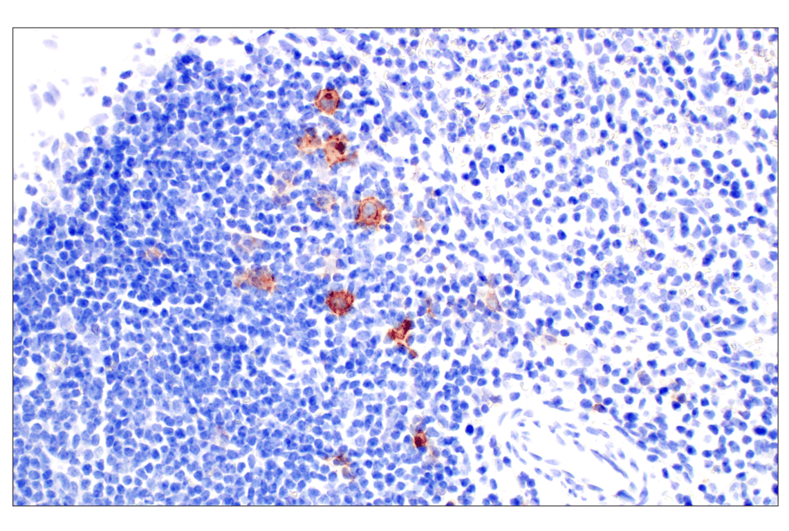Immunohistochemistry Image 5: TNFRSF8/CD30 (E7E4D) Rabbit Monoclonal Antibody (BSA and Azide Free)
