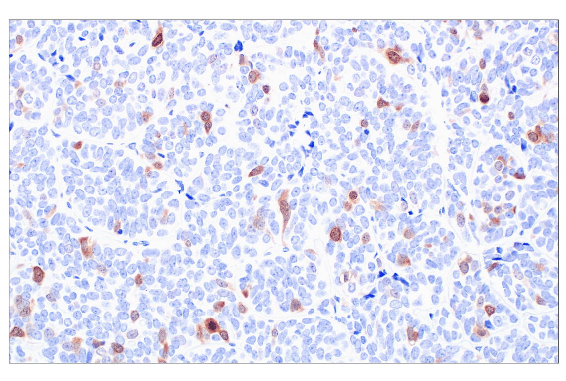 Immunohistochemistry Image 4: PBK/TOPK (F2X2Z) Rabbit Monoclonal Antibody