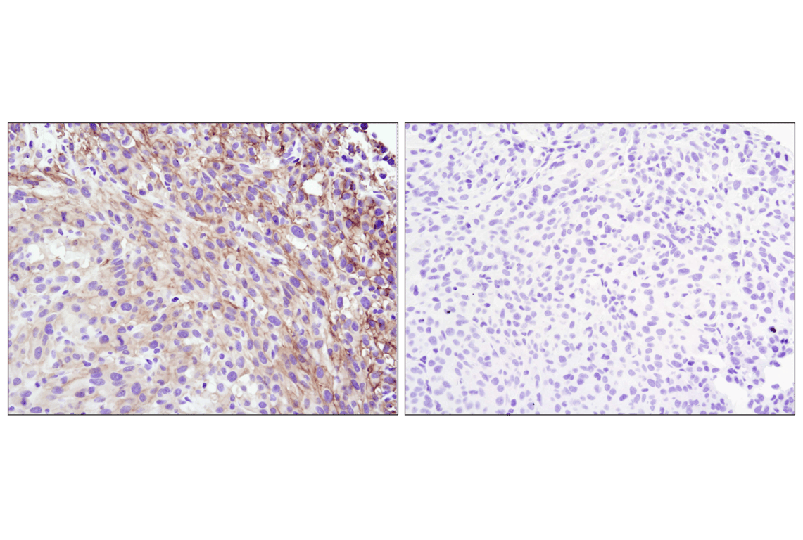 Immunohistochemistry Image 4: Phospho-Akt (Ser473) (D9E) Rabbit Monoclonal Antibody