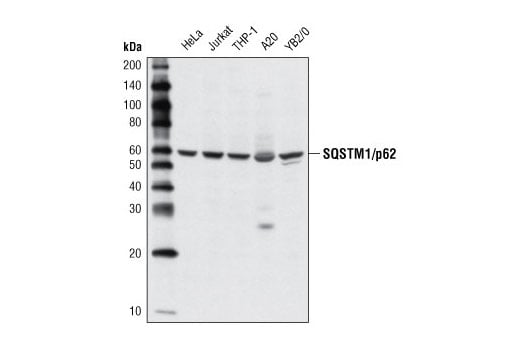 SQSTM1/p62 Antibody | Cell Signaling Technology