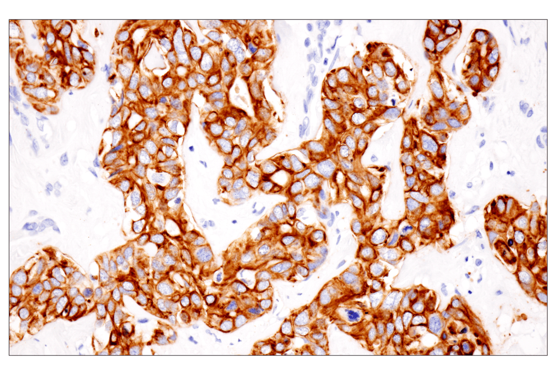 Immunohistochemistry Image 3: Pan-Keratin (Type II) (F6G1P) Rabbit Monoclonal Antibody