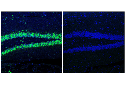 Immunofluorescence Image 1: Cas9 (<i>S. pyogenes</i>) (D8Y4K) Rabbit Monoclonal Antibody