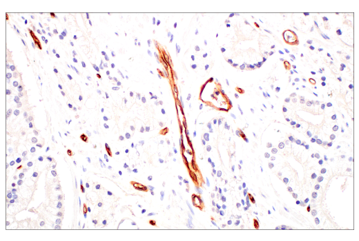 Immunohistochemistry Image 6: PLVAP (E3X9D) Rabbit Monoclonal Antibody