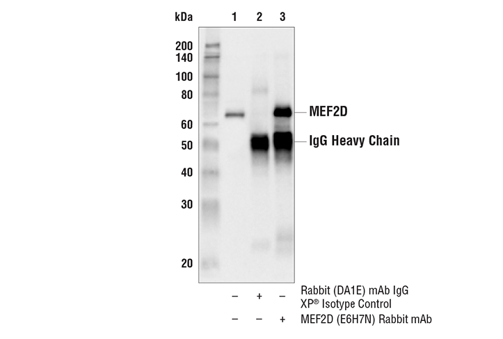 Immunoprecipitation Image 1: MEF2D (E6H7N) Rabbit Monoclonal Antibody