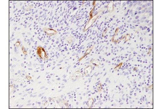 Immunohistochemistry Image 2: Prostate Specific Membrane Antigen (D7I8E) Rabbit Monoclonal Antibody