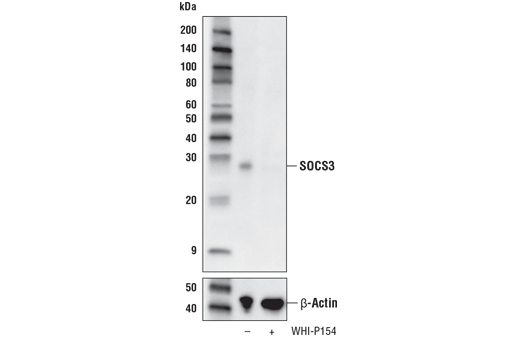 undefined Image 12: Jak/Stat Pathway Inhibitors Antibody Sampler Kit
