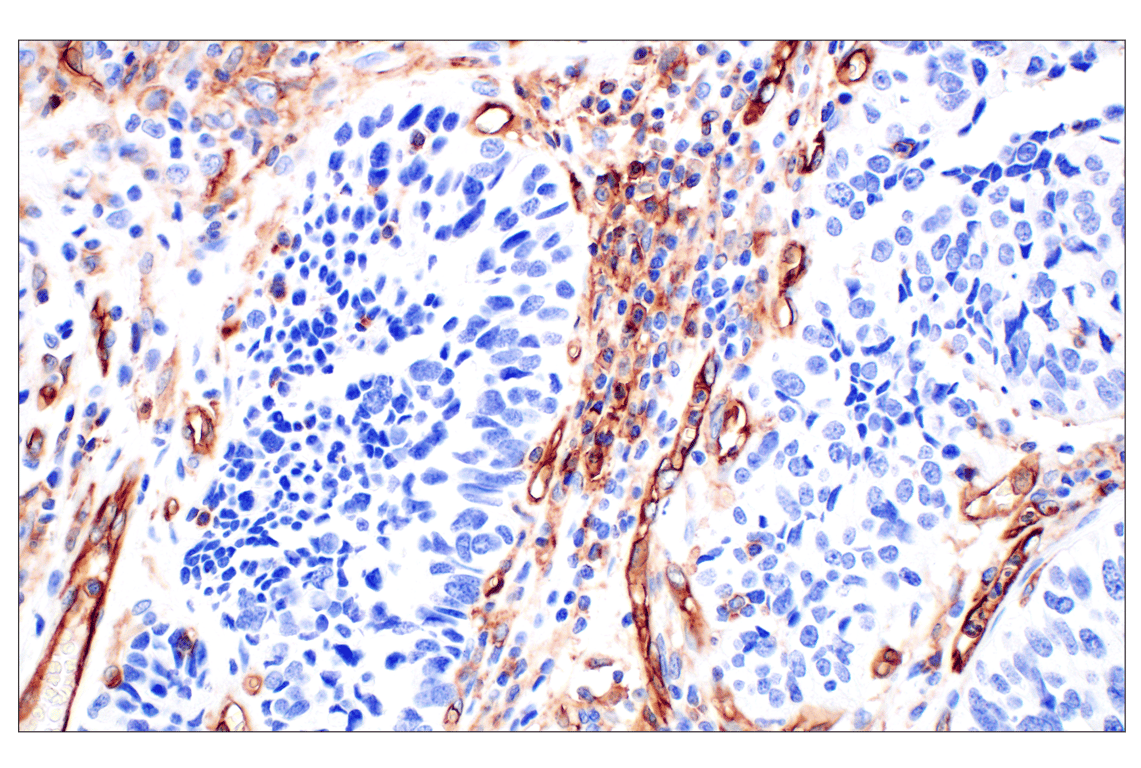 Immunohistochemistry Image 5: CD31 (PECAM-1) (F8M3S) Rabbit Monoclonal Antibody (BSA and Azide Free)