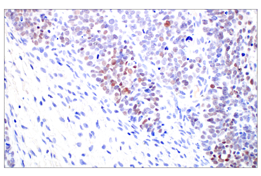 Immunohistochemistry Image 2: C/EBP beta (E2K1U) Rabbit Monoclonal Antibody (BSA and Azide Free)