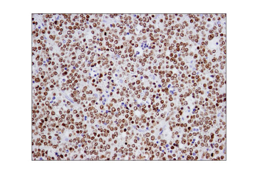 Immunohistochemistry Image 1: Ikaros (D6N9Y) Rabbit Monoclonal Antibody (BSA and Azide Free)