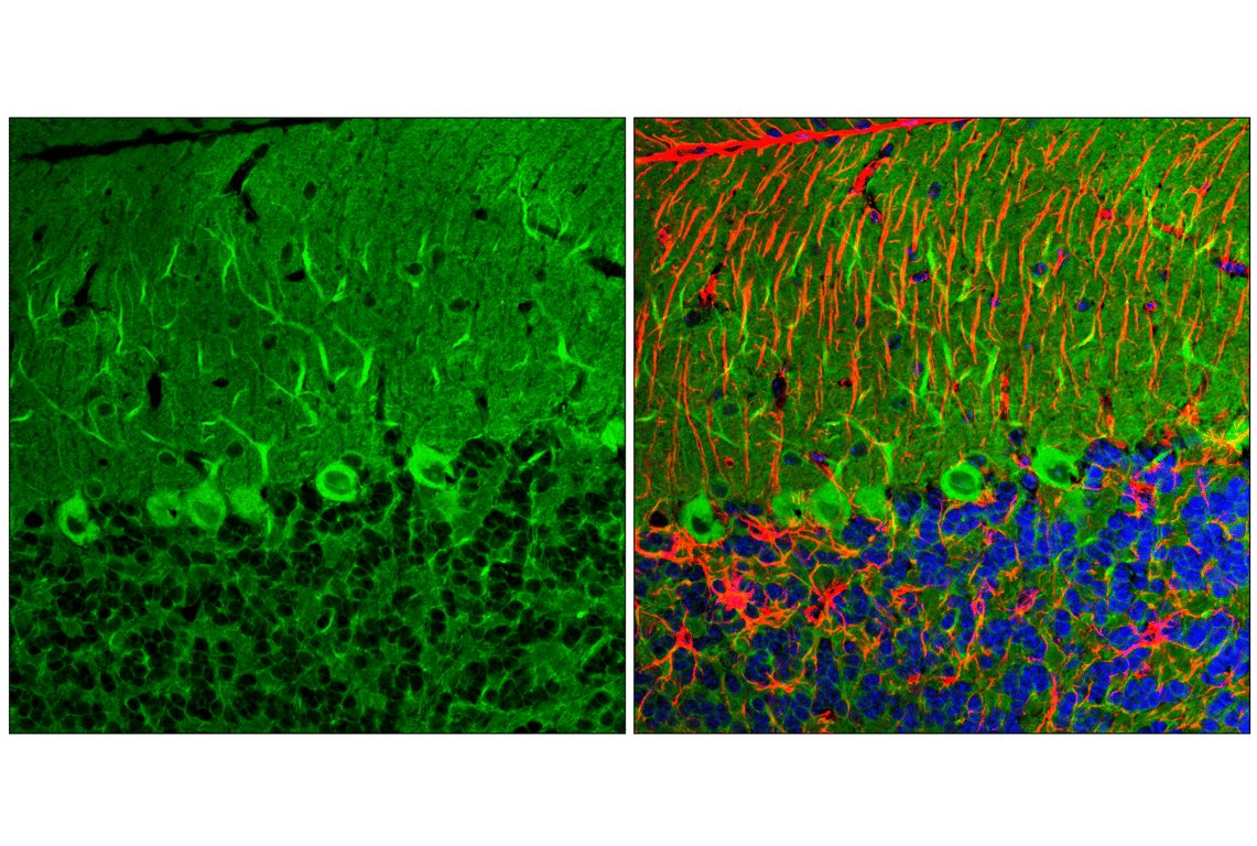 Immunofluorescence Image 1: LC3A/B (D3U4C) Rabbit Monoclonal Antibody (BSA and Azide Free)