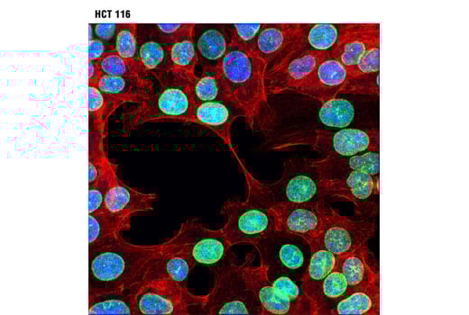 undefined Image 17: YAP/TAZ Transcriptional Targets Antibody Sampler Kit