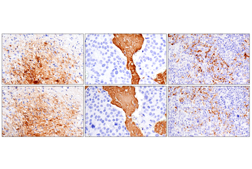 Immunohistochemistry Image 4: Fibrinogen gamma chain (E1U3Z) XP<sup>®</sup> Rabbit mAb (BSA and Azide Free)