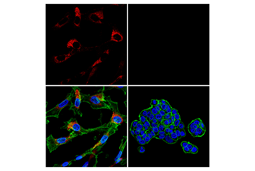 Immunofluorescence Image 1: COL1A1 (E8F4L) Rabbit Monoclonal Antibody (Alexa Fluor<sup>®</sup> 647 Conjugate)