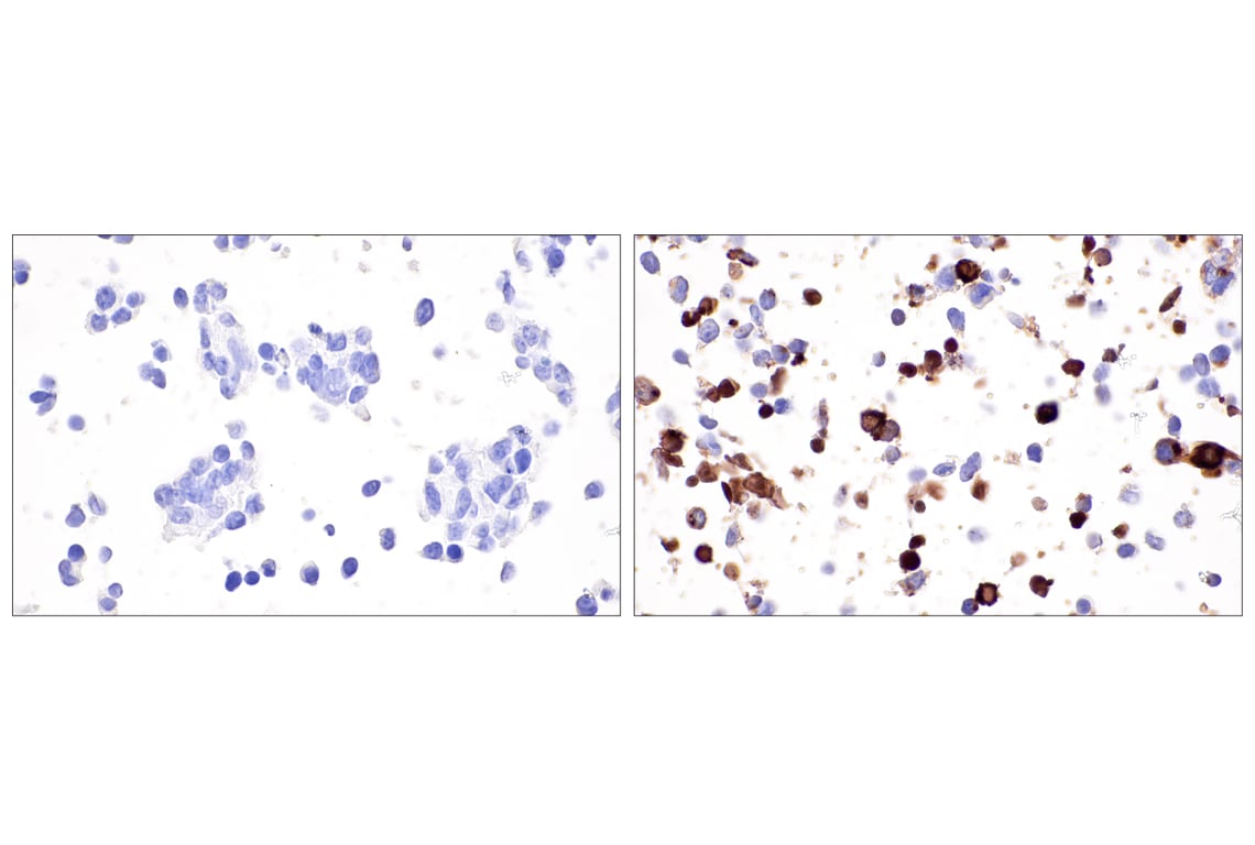 Immunohistochemistry Image 7: CXCL9/MIG (E6Z5W) Rabbit Monoclonal Antibody