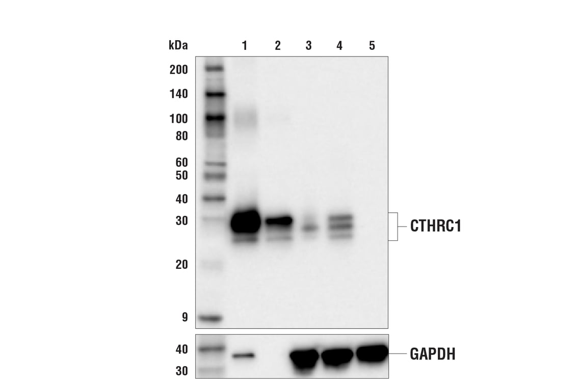 Western Blotting Image 1: CTHRC1 (E6W2E) Rabbit mAb